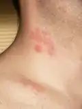 ਧ - ਧੌਣ Neck