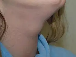 die Kehle