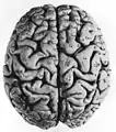 facies dorsalis cerebri gyri
