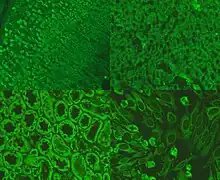 Picture of immunofluorescence staining pattern of AMA antibodies.