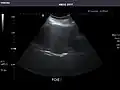 Liver