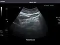 Pancreas
