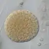 sporangium