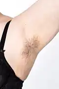 Normal underarm