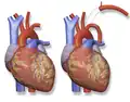Blalock–Thomas–Taussig Shunt – left subclavian artery to left pulmonary artery.