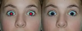 A photograph of a human with the red-eye effect and its correction right next to it