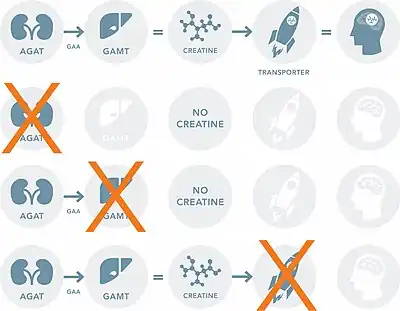 Depiction of normal creatine production pathway (top), creatine production in AGAT deficiency, creatine production in GAMT deficiency, creatine production in creatine transporter deficiency (bottom)