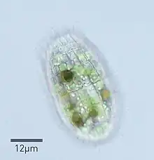 micrograph of a Coleps specimen