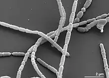 Several strand-like structures resting on top of and surrounding one another, the image is in black and white and the scale is at the micrometre level