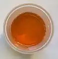 Dark urine due to low fluid intake.
