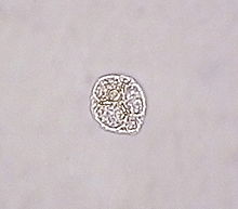 Ebria sp. (Cercozoa: Ebridea)