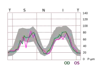 TSNIT graph