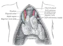 The thymus of a full-term fetus, exposed in situ.