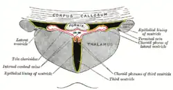 Coronal section of lateral and third ventricles