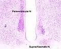 Cross-section of the monkey hypothalamus displays two of the major hypothalamic nuclei on either side of the fluid-filled third ventricle.