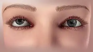 The visual axis of one eye is higher than the fellow fixating eye.