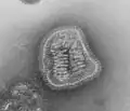 Influenza (Orthomyxoviridae)