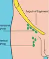 A view of the different inguinal lymph nodes