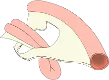 Diagram of a hernia: a loop of bowel protruding through a hole in tissue