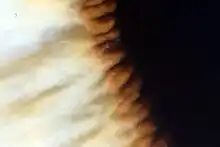 The iris dilator muscle fibers course radially through the iris.