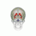 Position of lateral ventricles (shown in&nbsp;red)