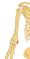 Right medial epicondyle colored in red.
