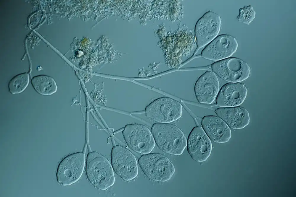 Mikrofoto.de-Vorticella_4