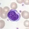 Lymphocyte