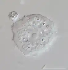 Acanthamoeba sp.