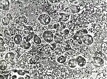 P. polycephalum amoebae growing on lawns of live E. coli. The bacterial cells are approx 1 micron in diameter, amoebae are approx 10 microns in diameter. Bright circular structures inside the amoebae are vacuoles, nuclei are pale grey circles each containing a darker nucleolus. (Phase contrast microscopy.)
