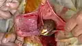 Leg of fetal lamb appearing out of the uterus during caesarean section