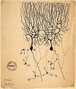 A drawing on yellowing paper with an archiving stamp in the corner. A spidery tree branch structure connects to the top of a mass. A few narrow processes follow away from the bottom of the mass.