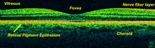 Time-Domain OCT of the macular area of a retina at 800&nbsp;nm, axial resolution 3&nbsp;μm