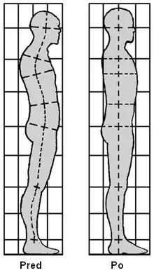 Two diagrams of a human figure in profile. The one on the left has a hunched posture, whereas the one on the right has an upright posture.
