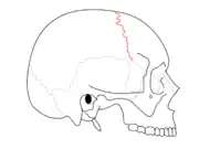 Coronal suture. It separates the parietal bones and the frontal bone.