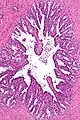 Low magnification micrograph of seminal vesicle. H&E stain.