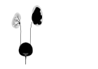 Pelvi-ureteric junction obstruction - easily mistaken for cystic renal disease on early scans