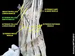 Extensor pollicis brevis muscle