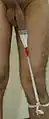 T-tape with a leg strap