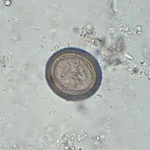 Egg of T. solium
