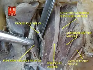 Lateral rectus muscle
