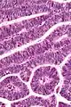 Very high magnification