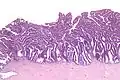 Very low magnification