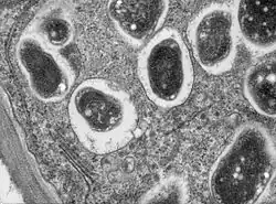 Transmission electron microscope image of a cross section though a soybean (Glycine max.Essex) root nodule (endophyte. The bacteria, Bradyrhyzobium japonicum, infects the roots and establishes a nitrogen fixing symbiosis. This high magnification image shows part of a cell with single bacteriods (bacterium-like cell or modified bacterial cell) within their symbiosomes. In his image, you can also see endoplasmic reticulum, dictysome and cell wall.